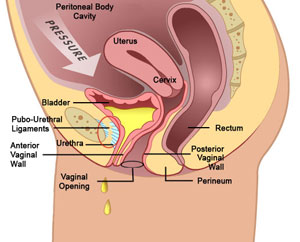 incontinenta urinara dupa operatia de prostata