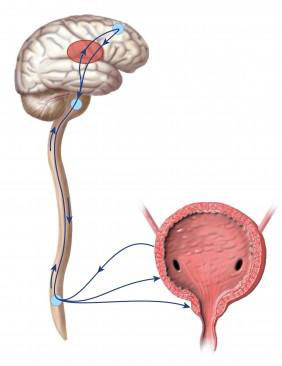 vezica neurogena forum
