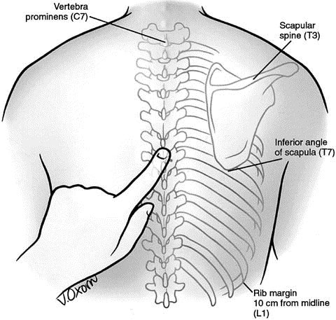 durere în partea superioară a coloanei vertebrale