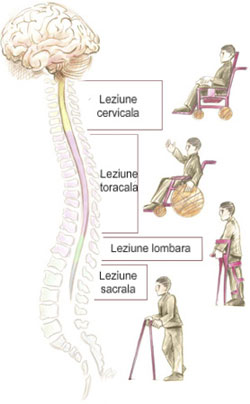 sectionarea maduvei spinarii