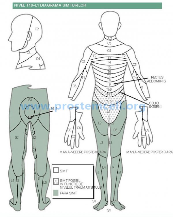 Functionalitatea leziunii coloanei vertebrale in zona vertebrelor T10 - L1