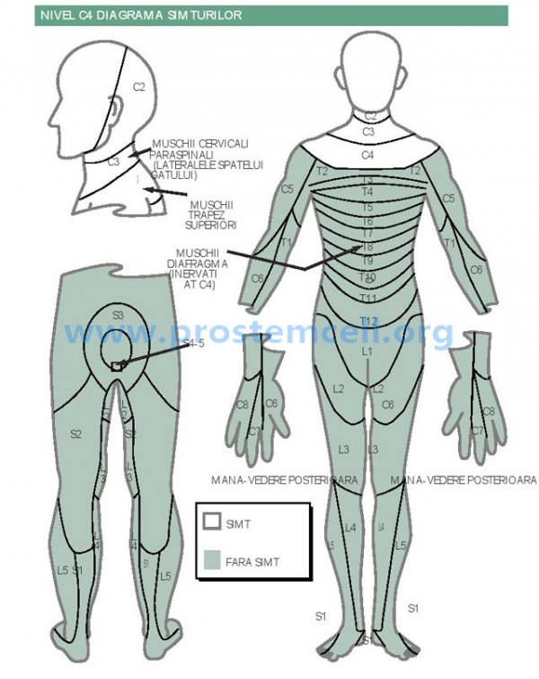 Functionalitatea leziunii coloanei vertebrale in zona vertebrei C4