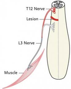 Descrierea schematica a inervarii musculare