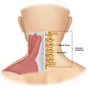 vertebră mare în regiunea cervicală)