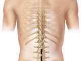 Decompresia coloanei vertebrale (laminectomie)